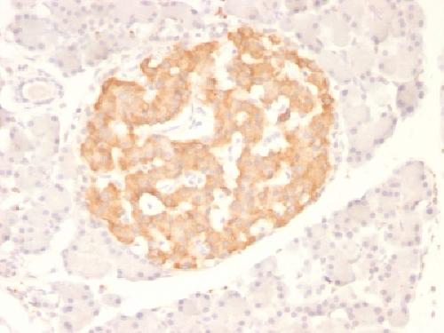 TNF Antibody