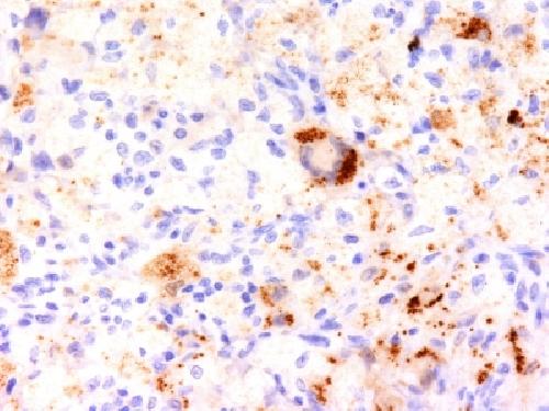 TNF Antibody