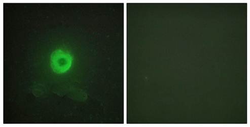 TNF Receptor II Antibody