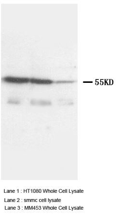 TNF Receptor I/TNFRSF1A Rabbit Polyclonal Antibody