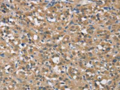 TNFRSF10D Antibody