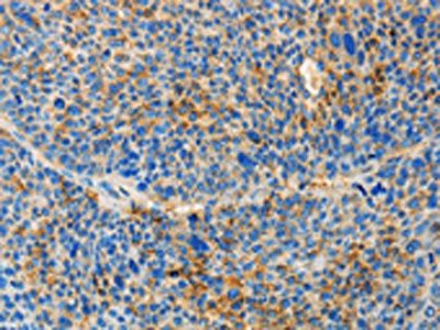 TNFSF13 Antibody