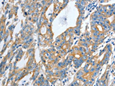 TNFSF13 Antibody