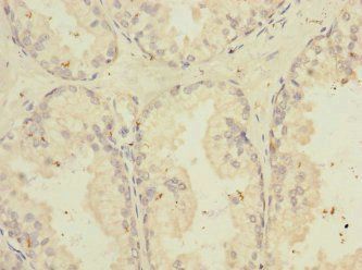 TNFSF15 Antibody