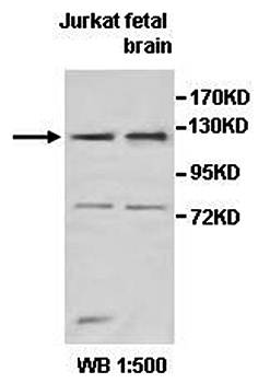 TNKS2 Rabbit Polyclonal Antibody
