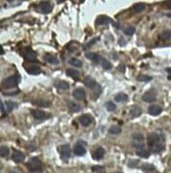 TNKS2 Rabbit Polyclonal Antibody