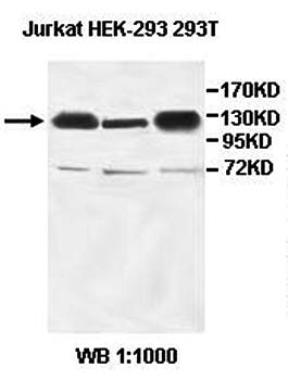 TNKS2 Rabbit Polyclonal Antibody
