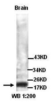 TNNI2 Rabbit Polyclonal Antibody