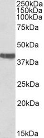 cardiac troponin T Antibody