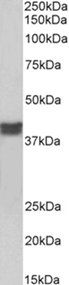 cardiac troponin T Antibody