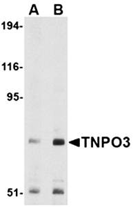 TNPO3 Antibody