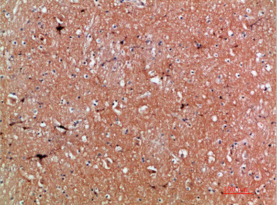 TNR Antibody