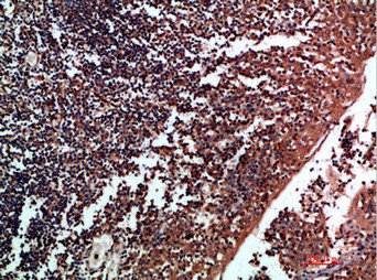 TNR Antibody