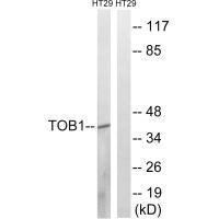 TOB1 Antibody