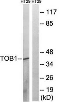 TOB1 (Phospho-Ser164) Antibody