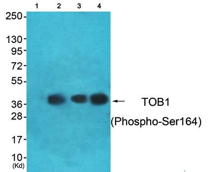 TOB1 (Phospho-Ser164) Antibody