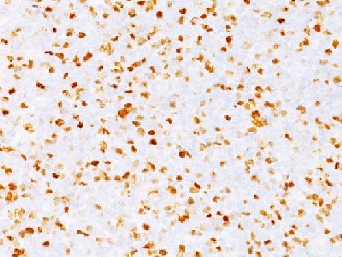 TOP2A Antibody