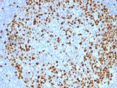 TOP2A Antibody