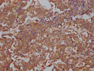 TOP2A Antibody