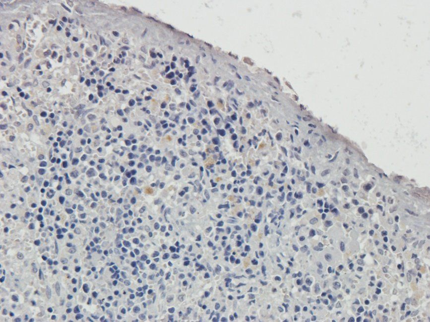 TOR1B Rabbit Polyclonal Antibody