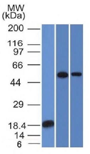 TOX3 Antibody