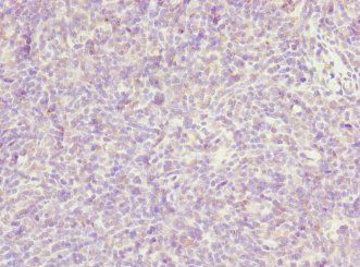 TP53AIP1 Antibody