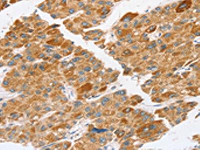 TP53I11 Antibody