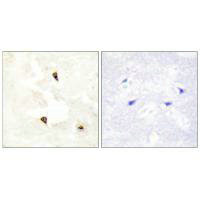 TP53I11 Antibody