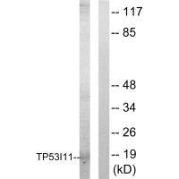 TP53I11 Antibody