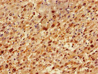TP53INP1 Antibody