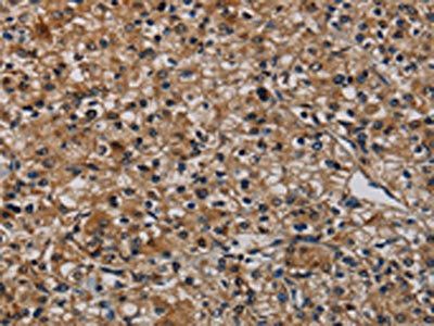 TP53INP1 Antibody
