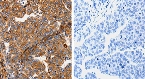 TPM2 Rabbit Polyclonal Antibody