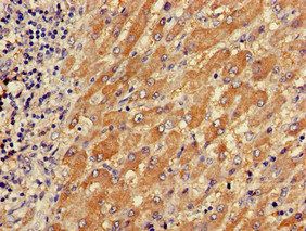TPM3 Antibody