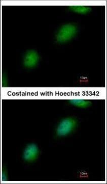 TPRKB Rabbit Polyclonal Antibody