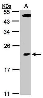 TPRKB Rabbit Polyclonal Antibody
