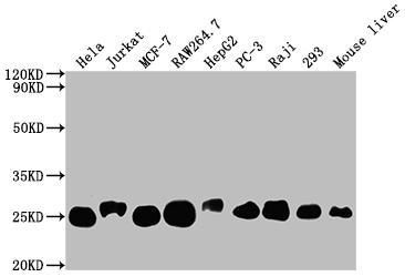 TPT1 Antibody