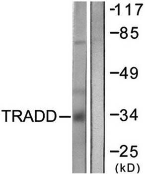 TRADD Antibody
