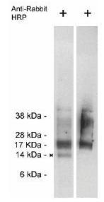 Rabbit Human Trag 3 (Taxol-resistant-associated protein 3) Antibody