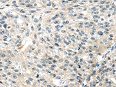 TRAIP Antibody