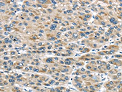 TRAIP Antibody