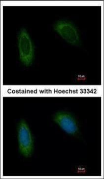translocation associated membrane protein 1 Antibody