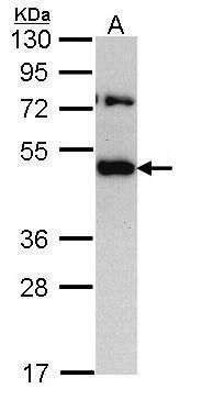 translocation associated membrane protein 1 Antibody