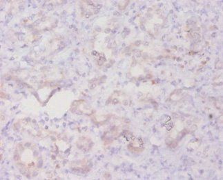 TGFB3 Antibody