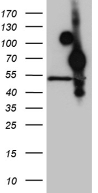 Transglutaminase 2 Antibody