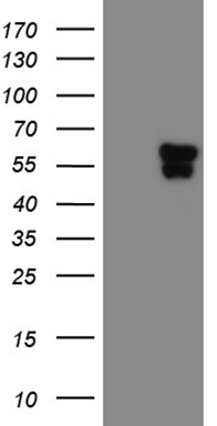 Transglutaminase 2 Antibody