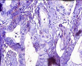TTR Antibody