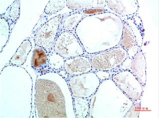 TTR Antibody