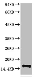 TTR Antibody