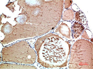 TTR Antibody
