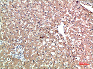 TTR Antibody